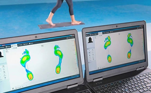Переносная бароподометрическая платформа - Footscan - Materialise UK
