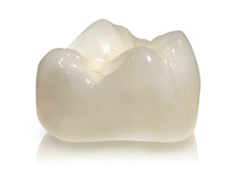 Циркониевая зубная коронка - DIAMOND - Derby Dental - для задних зубов / полупрозрачная