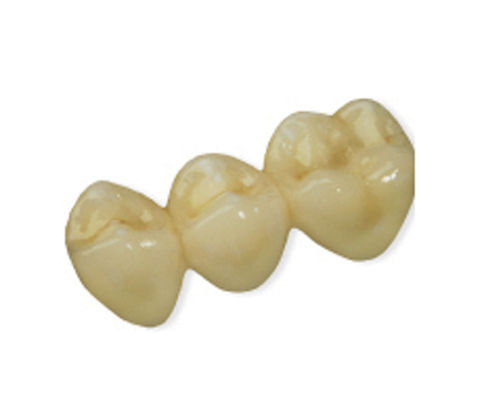 Зубной мост из PMMA - CAD Temp  - Derby Dental - для передних зубов / для задних зубов