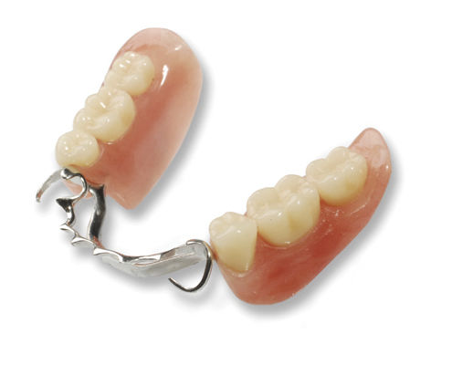 Стоматологический протез для передних зубов - Cast Partial  - Derby Dental - для задних зубов