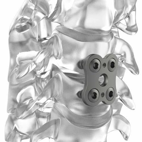 Костная пластина для артродеза шеи - PM BUTTERFLY® - NEURO FRANCE Implants - блокируемая / из титана / 2 уровня
