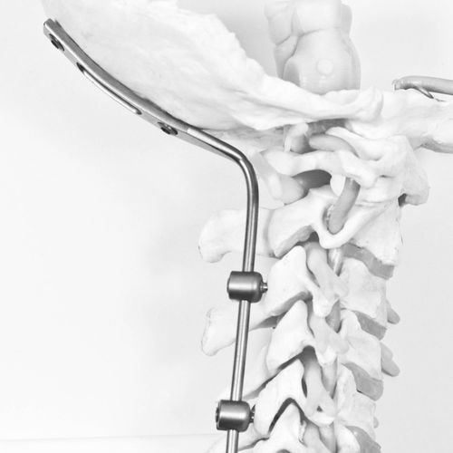 Затылочно-шейная система остеосинтеза - J.O.C. - NEURO FRANCE Implants - через задний отдел