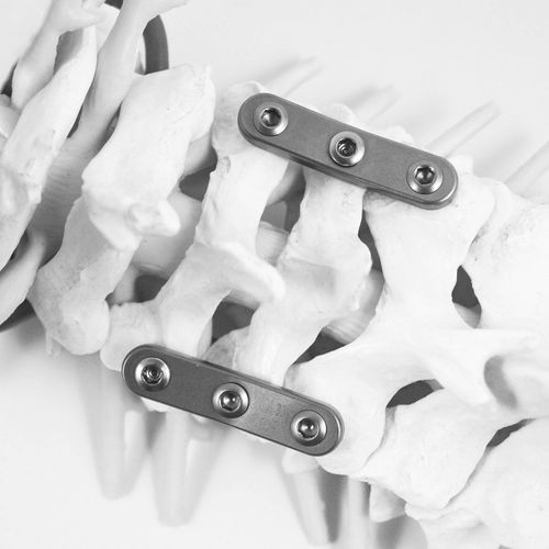 Костная пластина для артродеза для шейного позвонка - STABILAR® PCP - NEURO FRANCE Implants - неблокируемая / из титана