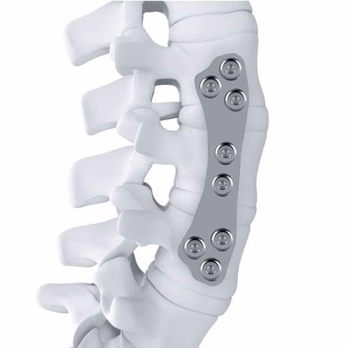 Костная пластина для артродеза для поясничной зоны - ARTHEMIS - NEURO FRANCE Implants - для грудо-поясничной зоны / переднебоковая / из титана
