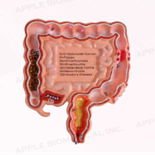 Анатомическая модель толстой кишки - A345 - Apple Biomedical - гастроэнтерологии / для образовательных целей / розовая