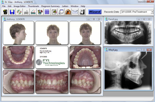 Программное обеспечение для цефалометрического анализа - Dr. View - For Your Imaging Technologies - ортодонтическое