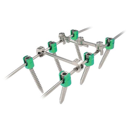 Система остеосинтеза для грудо-поясничной зоны - Rapidfix  - NORMMED Medical Devices - через задний отдел