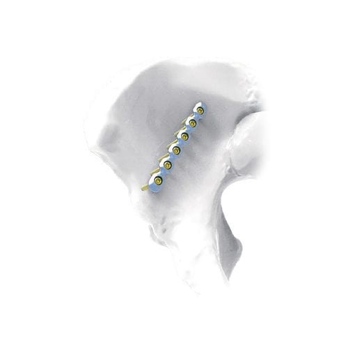 Компрессионная костная пластина таз - Straight - NORMMED Medical Devices - блокируемая / металлическая