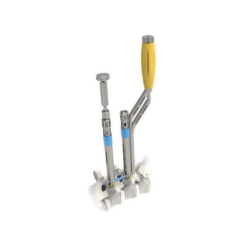 Мини-инвазивная система позиционирования педикулярных винтов - ARES  - NORMMED Medical Devices