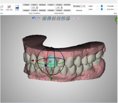 Ортодонтическое программное обеспечение - PLAN - VERSION 5.0 - Orchestrate Orthodontic Technologies - для контроля / для разработки / Windows