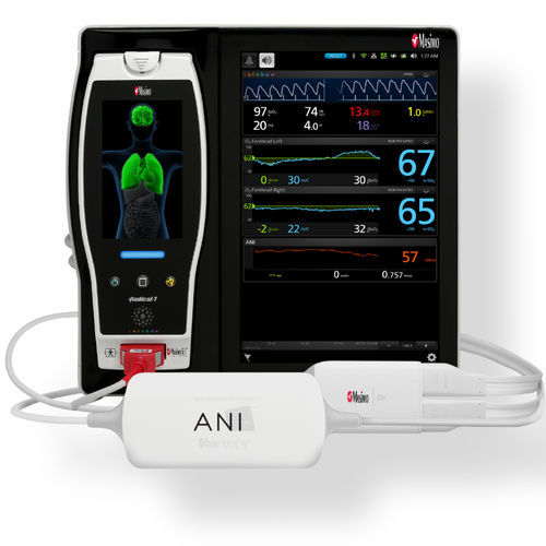 Модуль для монитора пациента ANI - ANI MOC-9 V1 - Mdoloris Medical Systems - для анальгезии / для интенсивной терапии / для операционного блока