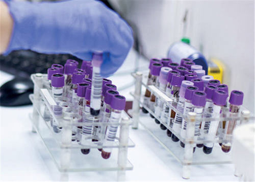 LIMS для составления отчетности - TDNexLabs - TECHNIDATA - для анализа / для управления / для утверждения