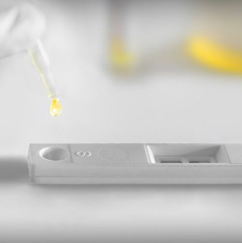 Экспресс-тест рак мочевого пузыря - UBC® - IDL Biotech - для онкологии / на опухолевые маркеры / для мочи