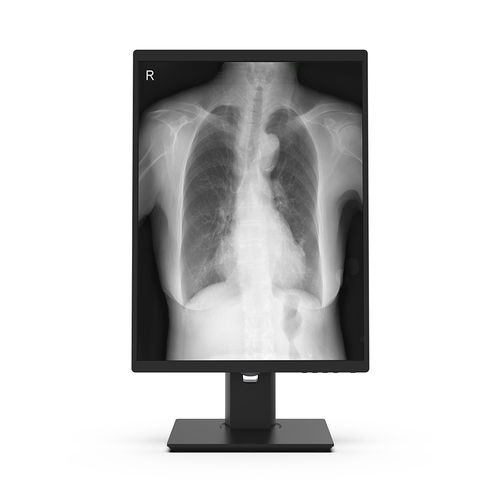 Медицинский монитор - 21X3M-I3 - KTC Medical Solutions - хирургический / для диагностики / для рентгенологии
