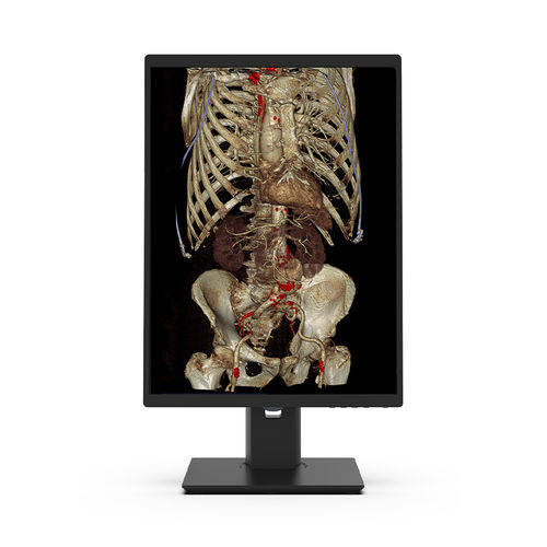 Медицинский монитор - 21X3C-I3 - KTC Medical Solutions - для диагностики / для рентгенологии / 21,3"