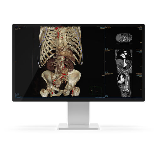 Медицинский монитор - 27X4C-K1 - KTC Medical Solutions - для диагностики / для рентгенологии / QHD