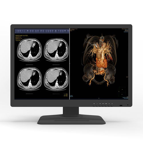 Медицинский монитор - 30X6C - KTC Medical Solutions - для диагностики / для рентгенологии / 30"