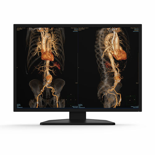 Медицинский монитор - 31X12C - KTC Medical Solutions - для диагностики / для рентгенологии / разрешение 4K