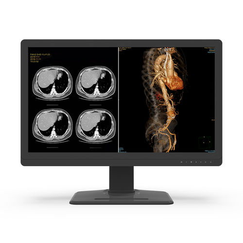 Медицинский монитор - 32X8C-L0S - KTC Medical Solutions - для диагностики / для рентгенологии / 3840×2160
