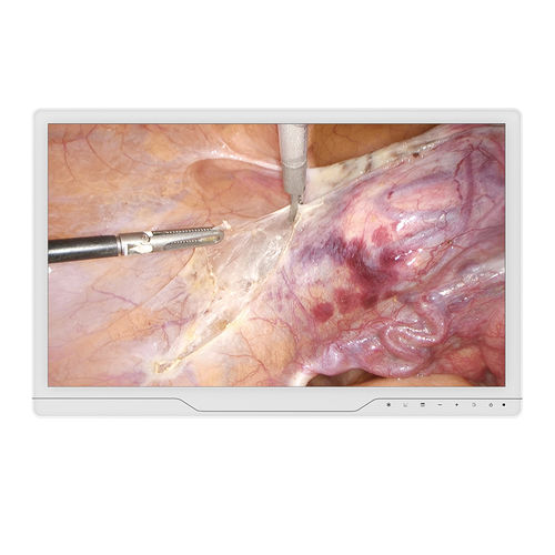 Медицинский монитор - 22A30 - KTC Medical Solutions - для эндоскопии / 1920x1080 / 21,5"