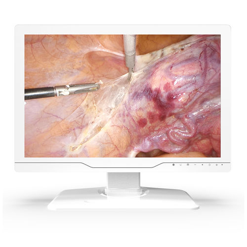 Медицинский монитор - 24A30 - KTC Medical Solutions - для операционной / для эндоскопии / 1920x1200