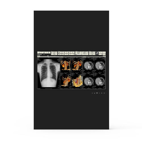 Медицинский монитор - 24H90 - KTC Medical Solutions - для операционной / 1920x1080 / 23,8"