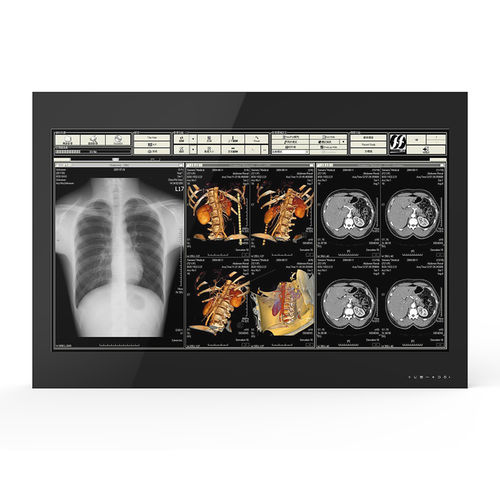 Медицинский монитор - 55H90 - KTC Medical Solutions - для операционной / 3840×2160 / 55"