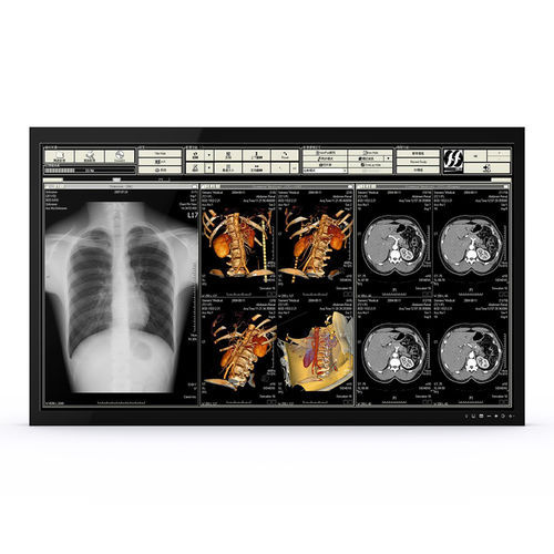 Медицинский монитор - 65H90 - KTC Medical Solutions - для операционной / 3840×2160 / 65"
