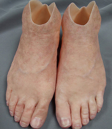 Эстетический протез ступня - Medical Art Prosthetics - для взрослых