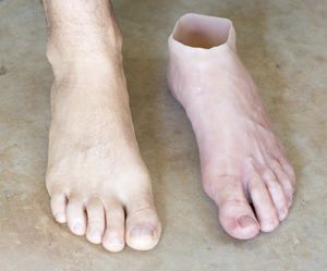Эстетический протез ступня - Northern Prosthetics - для взрослых