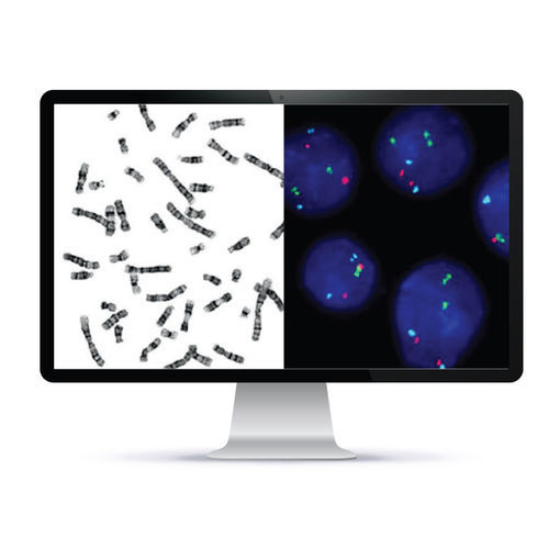 Автоматизированная система клеточной визуализации - CytoPower™ - Applied Spectral Imaging - для лабораторий / цитогенетическая / FISH