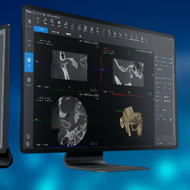Медицинское программное обеспечение - SmartV-ENT - LargeV Instrument - для стоматологической имплантологии / для медицинских снимков / ЛОР
