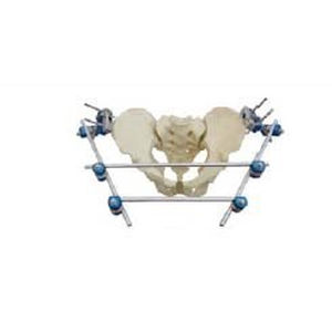 Внешний фиксатор таза - T8012 - Orthopromed - трубчатый
