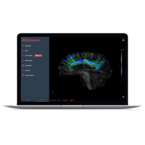 Программное обеспечение для анализа изображений - Brainance MD  - Advantis Medical Imaging - для составления отчетности / для визуализации 3D / для визуализации DICOM