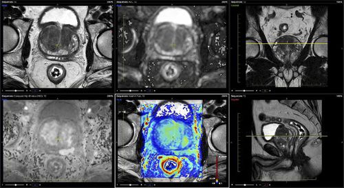 Программное обеспечение для анализа - Advantis Medical Imaging - для составления отчетности / визуализатор / для МРТ