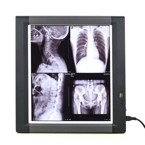 Цифровой негатоскоп - MG01 - Nanchang Micare Medical Equipment - 1 диапазон / с выключателем / светодиод