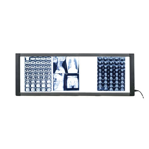 Цифровой негатоскоп - MG04 - Nanchang Micare Medical Equipment - 4 диапазона / с выключателем / светодиод