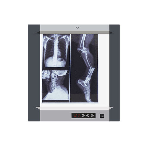 Цифровой негатоскоп - MG-01 - Nanchang Micare Medical Equipment - 1 диапазон / с белым светом / с выключателем