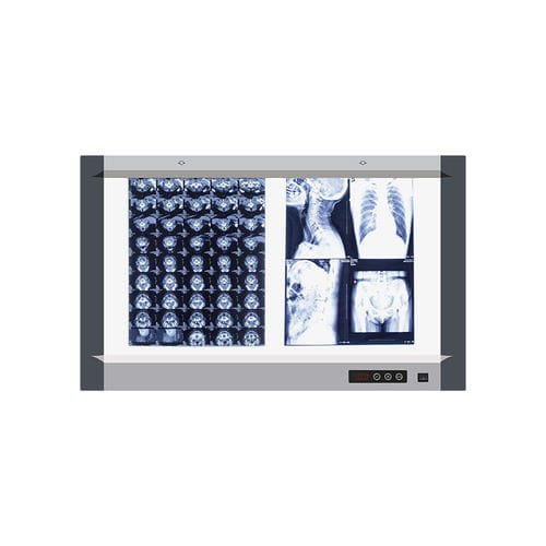 Цифровой негатоскоп - MG-02 - Nanchang Micare Medical Equipment - 2 диапазона / с белым светом / с выключателем