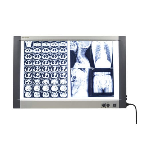 Негатоскоп 2 диапазона - MG-02X - Nanchang Micare Medical Equipment - с белым светом / с выключателем / для маммографии