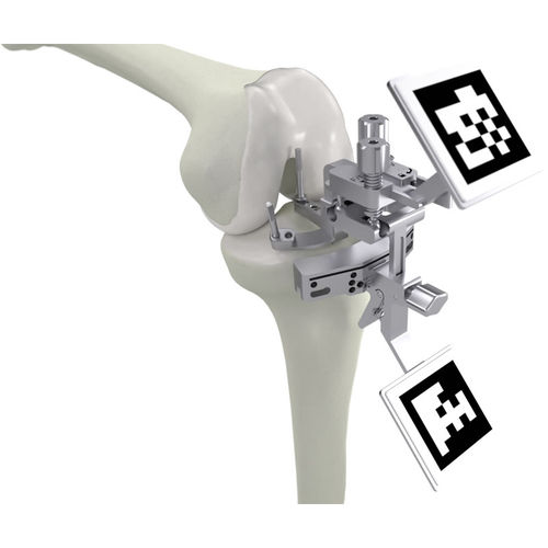 Система анализа движения ПКС - PIXEE KNEE + - Gruppo Bioimpianti - кинематики коленного сустава / визуализация 3D