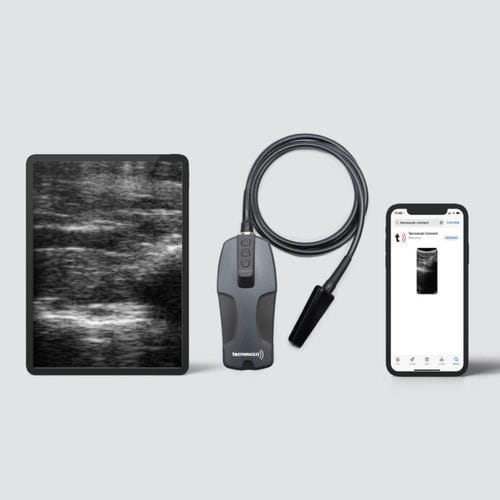 Переносной ветеринарный ультразвуковой сканер - BL Tecnoscan - Tecnovet - многоцелевой / беспроводной зонд