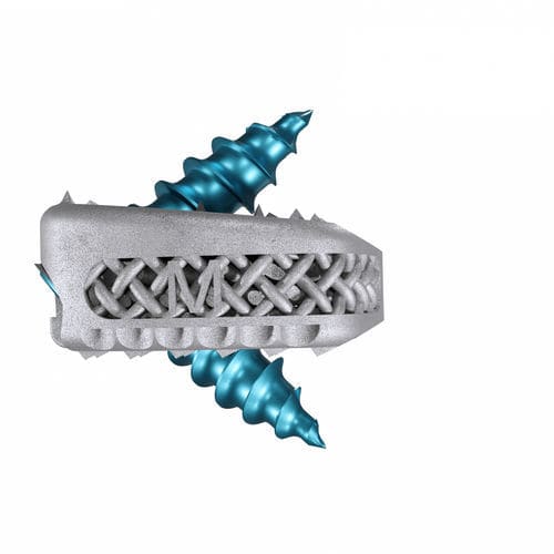 Межтеловой кейдж шеи - Magnolis® Z - Maxxspine Innovative - через передний отдел