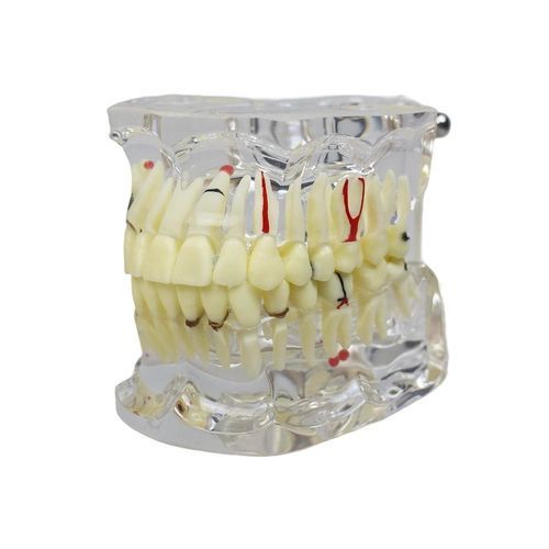 Анатомическая модель прорезывание зубов - JG-Y15-IM - FOSHAN JINGLE MEDICAL EQUIPMENT CO., LTD - корневого канала / для стоматологии / из полимера