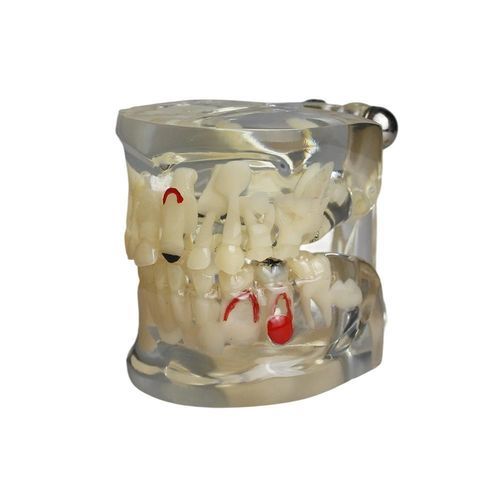 Анатомическая модель зубов - JG-Y15-RJ - FOSHAN JINGLE MEDICAL EQUIPMENT CO., LTD - прорезывание зубов / учебная / ребенок