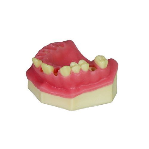 Десневая анатомическая модель - JG-Y8-F3 - FOSHAN JINGLE MEDICAL EQUIPMENT CO., LTD - кости / хирургическая / учебная