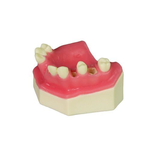 Анатомическая модель для стоматологии - JG-YZ-15 - FOSHAN JINGLE MEDICAL EQUIPMENT CO., LTD - десневая / кости / хирургическая