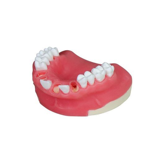 Анатомическая модель нижней челюсти - JG-Y8-F2 - FOSHAN JINGLE MEDICAL EQUIPMENT CO., LTD - зубов / десен / хирургическая