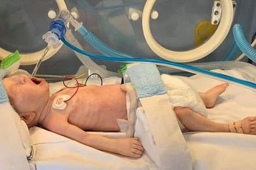 Симулятор пациента для управления воздушными путями - PREM & FULL TERM - LifeCast Body Simulation Ltd - для RCP / для педиатрии / для младенца