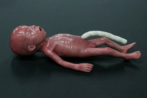 Учебный манекен для педиатрии - MICRO-PREEMIE - LifeCast Body Simulation Ltd - пневмоторакса / для младенца / из силикона